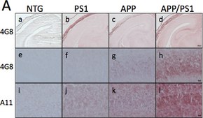 Anti-Amyloid Oligomer Antibody, &#945;&#946;, oligomeric serum, Chemicon&#174;