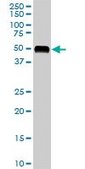 Monoclonal Anti-AGT antibody produced in mouse clone 1A10, purified immunoglobulin, buffered aqueous solution