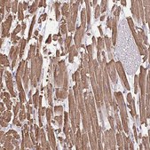 Anti-MYL2 antibody produced in rabbit Prestige Antibodies&#174; Powered by Atlas Antibodies, affinity isolated antibody, buffered aqueous glycerol solution