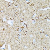 [KO Validated]Anti-SLC25A4/ANT1 Antibody, clone 3C1Q3, Rabbit Monoclonal