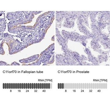 Anti-C11orf70 antibody produced in rabbit Prestige Antibodies&#174; Powered by Atlas Antibodies, affinity isolated antibody, buffered aqueous glycerol solution