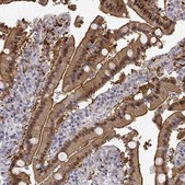 Anti-ADA antibody produced in rabbit Prestige Antibodies&#174; Powered by Atlas Antibodies, affinity isolated antibody, buffered aqueous glycerol solution