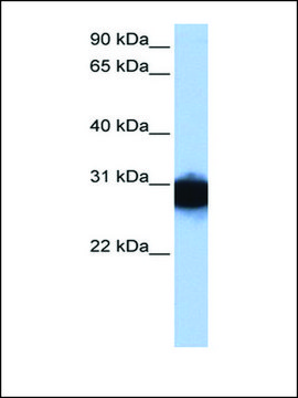 Anti-TPI1 antibody produced in rabbit affinity isolated antibody