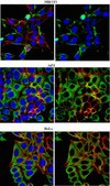 Anti-p62 (Sequestosome-1) Antibody, clone 11C9.2 clone 11C9.2, from mouse