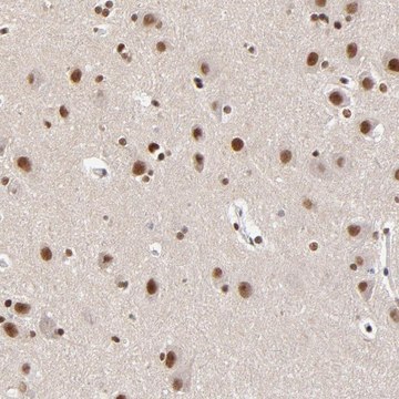 Anti-ZMYM3 antibody produced in rabbit Prestige Antibodies&#174; Powered by Atlas Antibodies, affinity isolated antibody, buffered aqueous glycerol solution