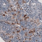 Monoclonal Anti-FCGRT antibody produced in mouse Prestige Antibodies&#174; Powered by Atlas Antibodies, clone CL3638, purified immunoglobulin, buffered aqueous glycerol solution