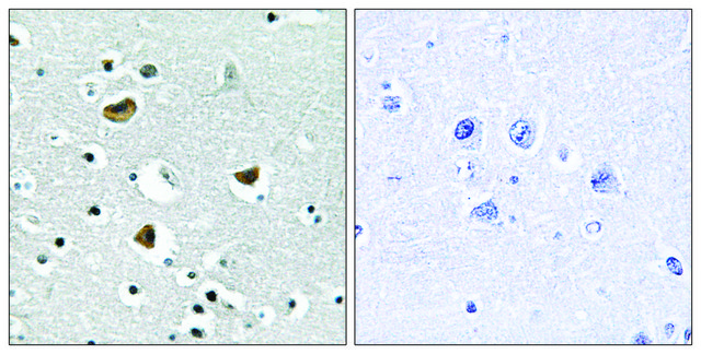 Anti-HMG17 antibody produced in rabbit affinity isolated antibody