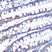 Anti-LOX antibody produced in rabbit