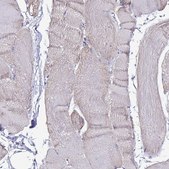 Anti-TMEM106C antibody produced in rabbit Prestige Antibodies&#174; Powered by Atlas Antibodies, affinity isolated antibody, buffered aqueous glycerol solution