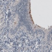 Monoclonal Anti-MUC16 antibody produced in mouse Prestige Antibodies&#174; Powered by Atlas Antibodies, clone CL2782, purified immunoglobulin