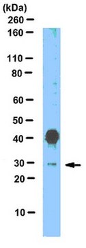 Anti-SNAI1 (Snail homolog 1) Antibody from rabbit, purified by affinity chromatography