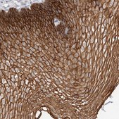 Anti-S100A14 antibody produced in rabbit Prestige Antibodies&#174; Powered by Atlas Antibodies, affinity isolated antibody, buffered aqueous glycerol solution