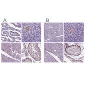 Anti-IGF2BP1 antibody produced in rabbit Prestige Antibodies&#174; Powered by Atlas Antibodies, affinity isolated antibody, buffered aqueous glycerol solution