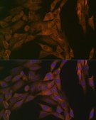 Anti-PP2A alpha + beta antibody produced in rabbit