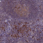 Anti-IL21R antibody produced in rabbit Prestige Antibodies&#174; Powered by Atlas Antibodies, affinity isolated antibody, buffered aqueous glycerol solution