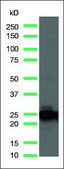 Anti-Kappa Light Chain antibody, Rabbit monoclonal clone SP148, recombinant, expressed in proprietary host, affinity isolated antibody