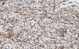 Anti-MBP Antibody, clone 2N6 , ZooMAb&#174; Rabbit Monoclonal recombinant, expressed in HEK 293 cells