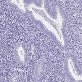 Anti-CR2 antibody produced in rabbit Prestige Antibodies&#174; Powered by Atlas Antibodies, affinity isolated antibody, buffered aqueous glycerol solution