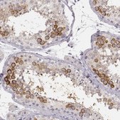 Anti-LY6K antibody produced in rabbit Prestige Antibodies&#174; Powered by Atlas Antibodies, affinity isolated antibody, buffered aqueous glycerol solution
