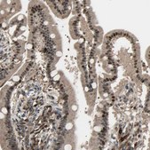 Anti-NUAK2 antibody produced in rabbit Prestige Antibodies&#174; Powered by Atlas Antibodies, affinity isolated antibody, buffered aqueous glycerol solution