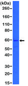 Anti-Cytokeratin 5 antibody, Rabbit monoclonal recombinant, expressed in HEK 293 cells, clone RM226, purified immunoglobulin