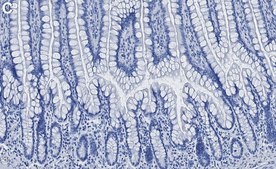 Anti-Calpain-1 Antibody, clone 1H14 ZooMAb&#174; Rabbit Monoclonal recombinant, expressed in HEK 293 cells