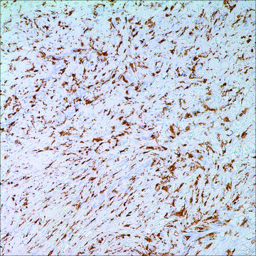 Factor XIIIa (EP3372) Rabbit Monoclonal Primary Antibody