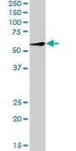 Anti-RBCK1 antibody produced in rabbit purified immunoglobulin, buffered aqueous solution