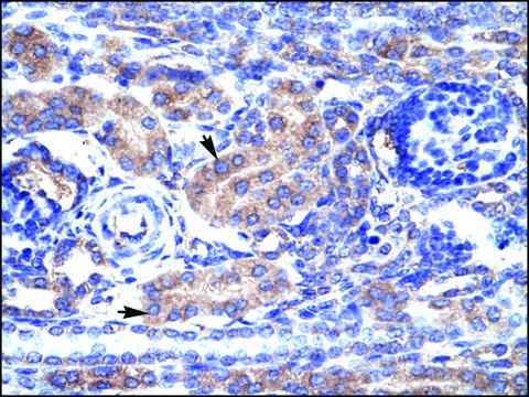 Anti-KCNAB3 antibody produced in rabbit IgG fraction of antiserum