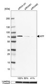 Anti-AFP antibody produced in rabbit Prestige Antibodies&#174; Powered by Atlas Antibodies, affinity isolated antibody, buffered aqueous glycerol solution