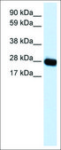 Anti-CAV3 antibody produced in rabbit affinity isolated antibody