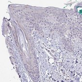 Anti-SYNPO2L antibody produced in rabbit Prestige Antibodies&#174; Powered by Atlas Antibodies, affinity isolated antibody, buffered aqueous glycerol solution