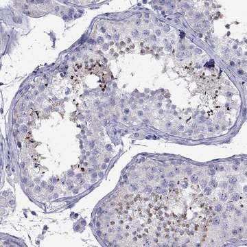 Anti-PATE1 antibody produced in rabbit Prestige Antibodies&#174; Powered by Atlas Antibodies, affinity isolated antibody