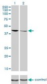 Monoclonal Anti-TARDBP antibody produced in mouse clone 2E2-D3, purified immunoglobulin, buffered aqueous solution