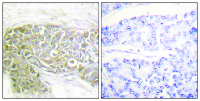 Anti-PEA-15 antibody produced in rabbit affinity isolated antibody