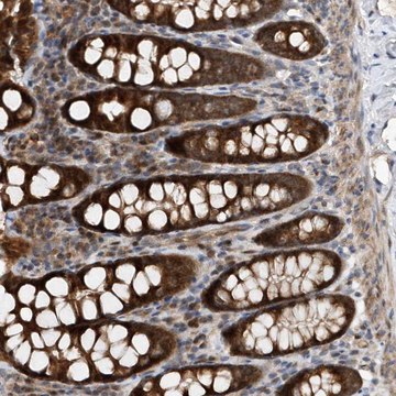 Anti-MMAA antibody produced in rabbit Prestige Antibodies&#174; Powered by Atlas Antibodies, affinity isolated antibody, buffered aqueous glycerol solution