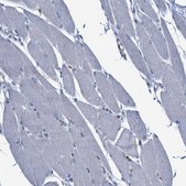 Anti-CCL2 antibody produced in rabbit Prestige Antibodies&#174; Powered by Atlas Antibodies, affinity isolated antibody, buffered aqueous glycerol solution