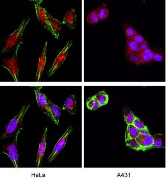 Anti-Akt/PKB Antibody, PH Domain, clone SKB1 clone SKB1, Upstate&#174;, from mouse