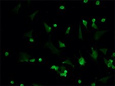 Anti-PM/Scl-100 antibody produced in rabbit ~1.0&#160;mg/mL, affinity isolated antibody, buffered aqueous solution