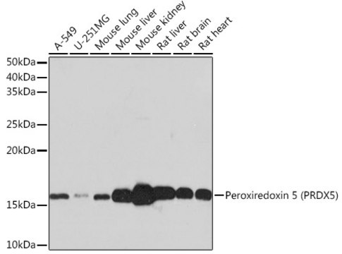 Anti-Peroxiredoxin 5 (PRDX5) Antibody, clone 5E10D3, Rabbit Monoclonal