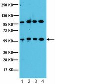 Anti-PP2A-B&#8217; (B56) Antibody from rabbit