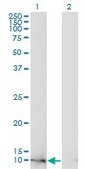 Monoclonal Anti-FABP4 antibody produced in mouse clone 2F12-1B11, ascites fluid, solution