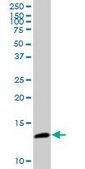 Anti-CDK2AP2 antibody produced in mouse purified immunoglobulin, buffered aqueous solution