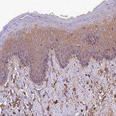 Anti-SOD3 antibody produced in rabbit Prestige Antibodies&#174; Powered by Atlas Antibodies, affinity isolated antibody, buffered aqueous glycerol solution