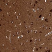 Anti-WDR37 antibody produced in rabbit Prestige Antibodies&#174; Powered by Atlas Antibodies, affinity isolated antibody, buffered aqueous glycerol solution