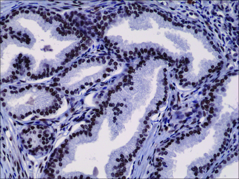 Anti-AR (n-terminal) antibody, Rabbit monoclonal recombinant, expressed in HEK 293 cells, clone RM254, purified immunoglobulin