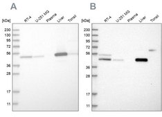 Anti-PCYT2 antibody produced in rabbit Prestige Antibodies&#174; Powered by Atlas Antibodies, affinity isolated antibody, buffered aqueous glycerol solution, Ab2