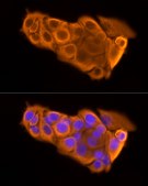 Anti-Cytokeratin 19 (KRT19) Antibody, clone 2Q5A5, Rabbit Monoclonal