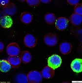 Anti-RSV type A Antibody, B Antibody, clone 133-1H ZooMAb&#174; Mouse Monoclonal recombinant, expressed in HEK 293 cells