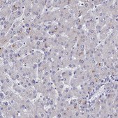 Anti-CHST5 antibody produced in rabbit Prestige Antibodies&#174; Powered by Atlas Antibodies, affinity isolated antibody, buffered aqueous glycerol solution